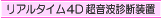 ���A���^�C���SD�����g�f�f���u